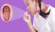 Bạch hầu: Nguyên nhân, triệu chứng, biến chứng và phòng ngừa bằng vắc-xin